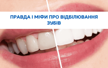 Правда і міфи про відбілювання зубів