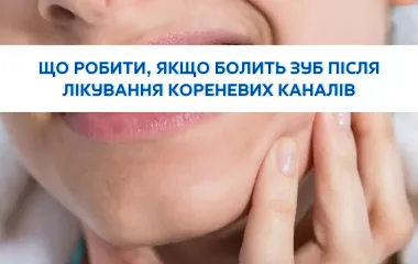 Що робити, якщо болить зуб після лікування кореневих каналів