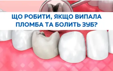 Що робити, якщо випала пломба та болить зуб?