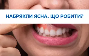 Набрякли ясна. Що робити?