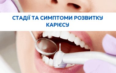 Стадії та симптоми розвитку карієсу