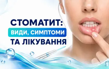 Стоматит: види, причини, симптоми та лікування