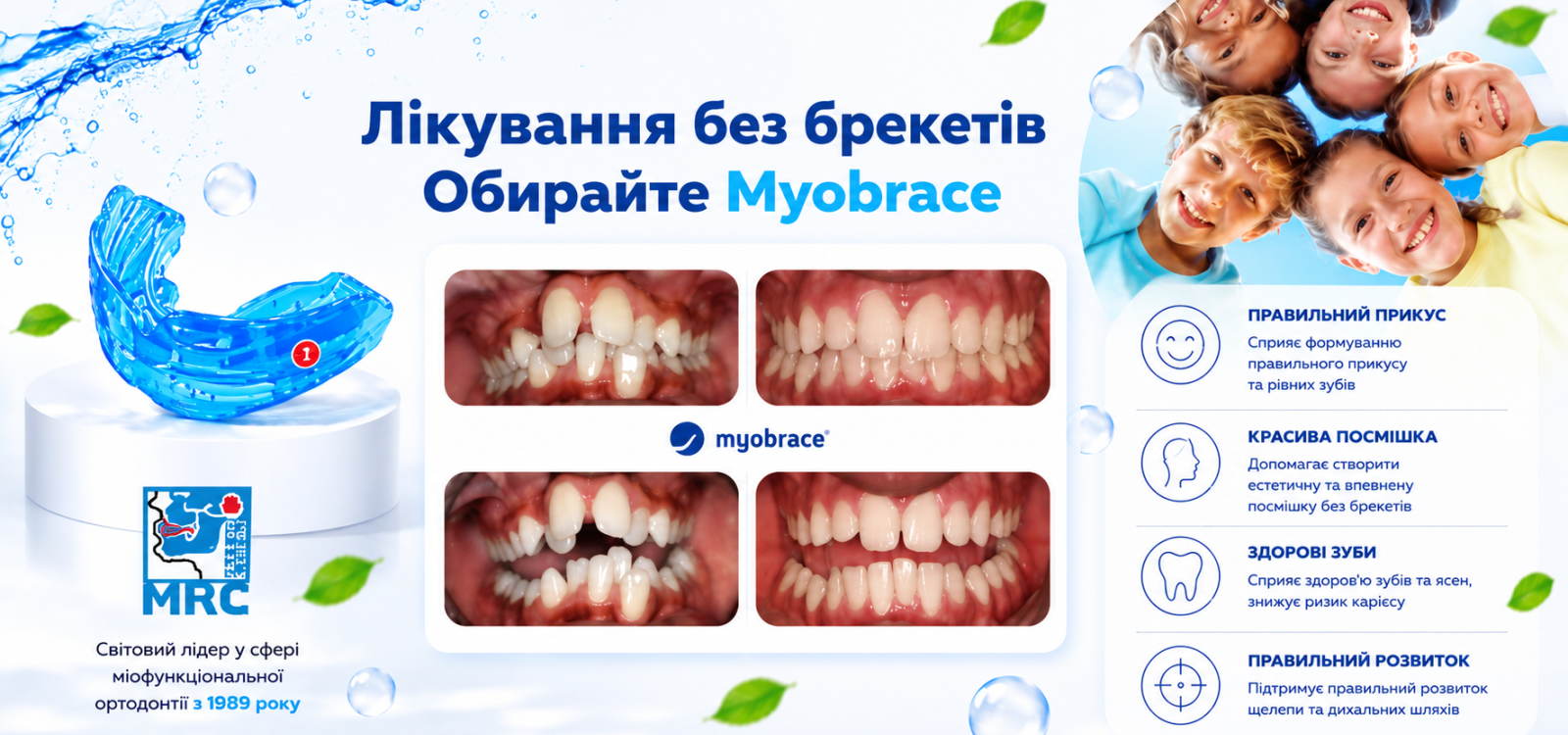 Лікування без брекетів. Обирайте Myobrace